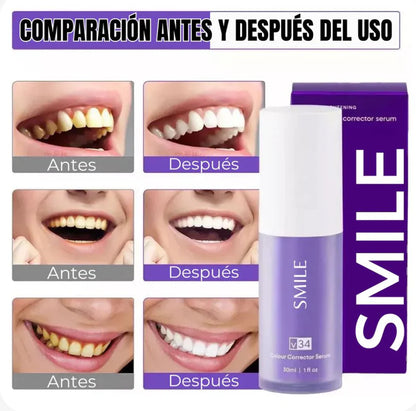 BrightSmile V34 - Blanqueador Dental + 2 Lápiz Blanqueador GRATIS